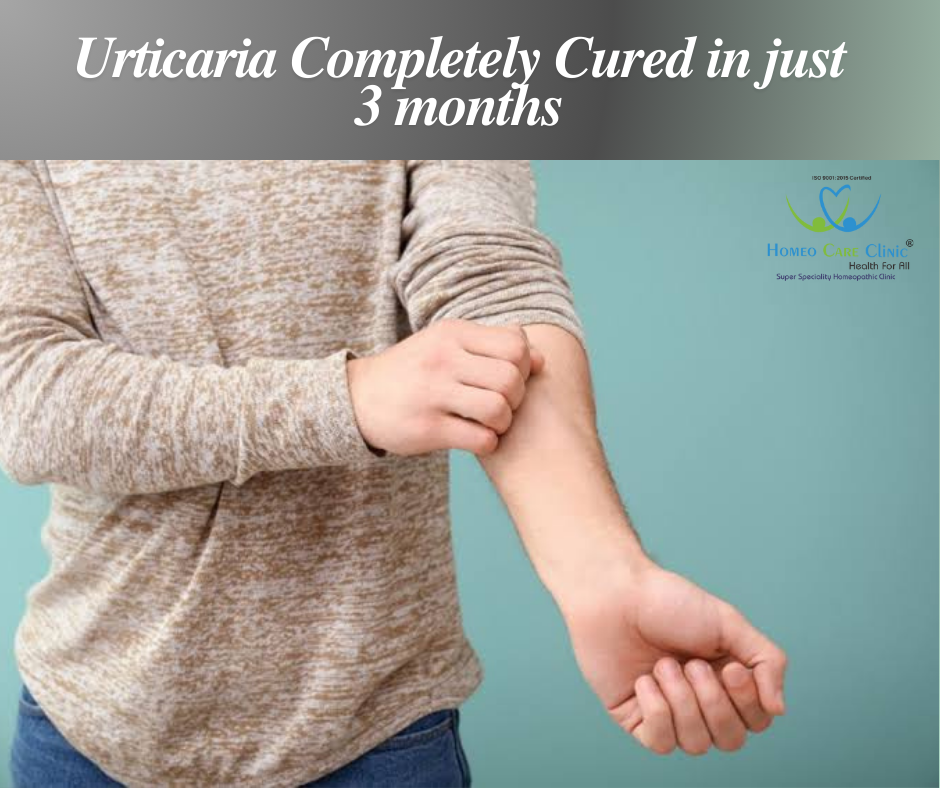 Urticaria treated in 3 months using homeopathy.