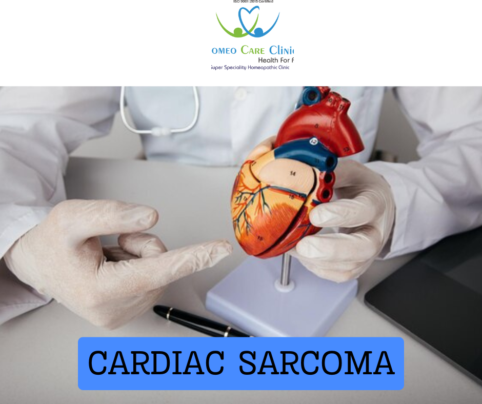 Cardiac sarcoma illustration showing heart angiosarcoma with highlighted stages