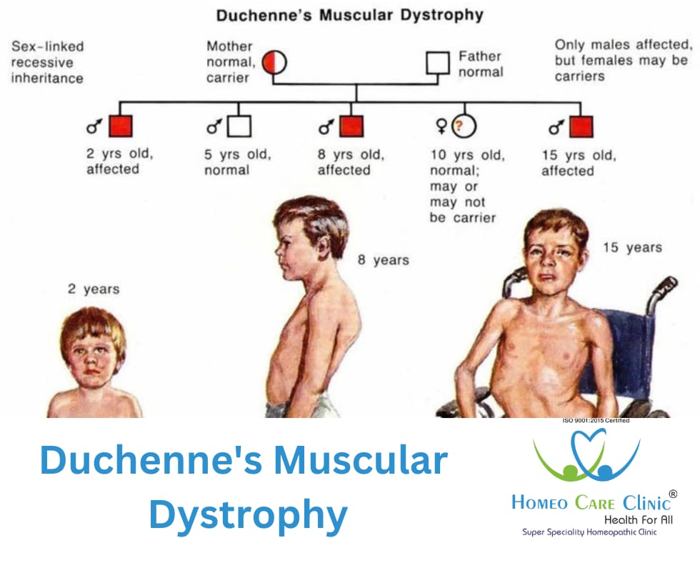 Duchenne Muscular Dystrophy and its effects