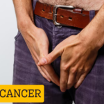 Penile Cancer Treatment process