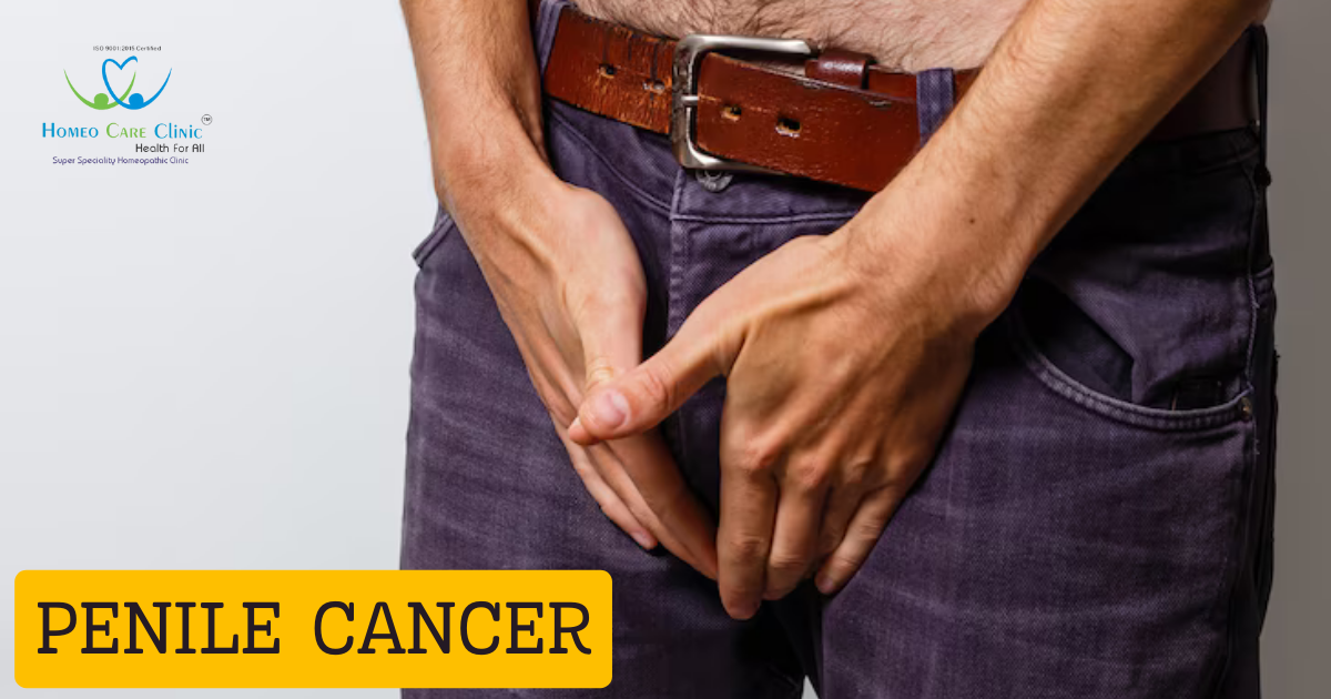 Penile Cancer Treatment process