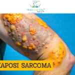 Supportive visual showing Kaposi Sarcoma awareness