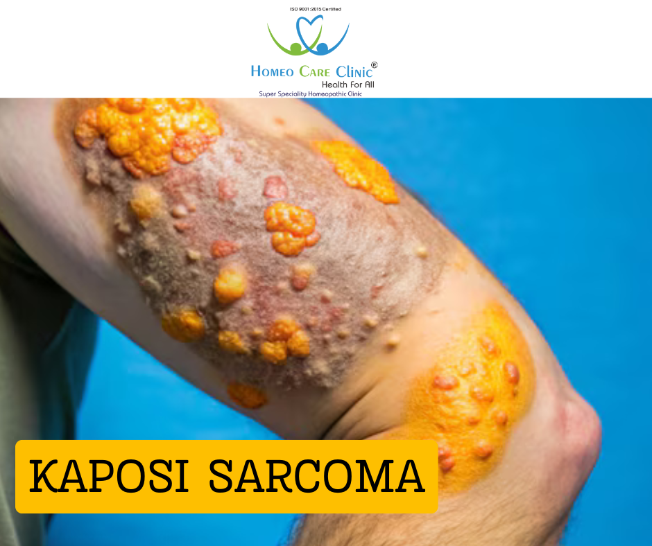 Supportive visual showing Kaposi Sarcoma awareness