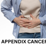 Appendix cancer causes