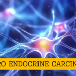 Neuroendocrine Carcinoma Treatments