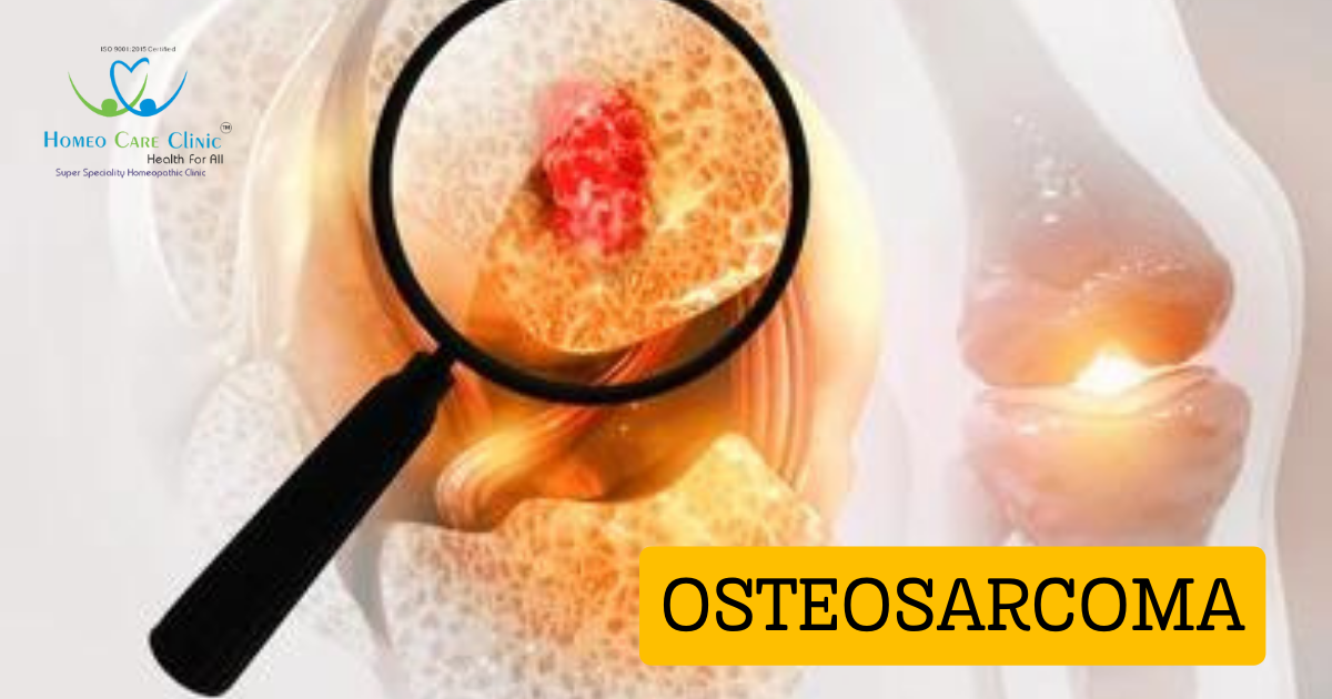 Osteosarcoma symptoms and treatment