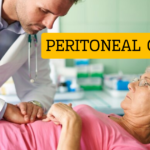 Peritoneal cancer causes