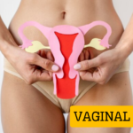 Vaginal Cancer: Causes and Treatment