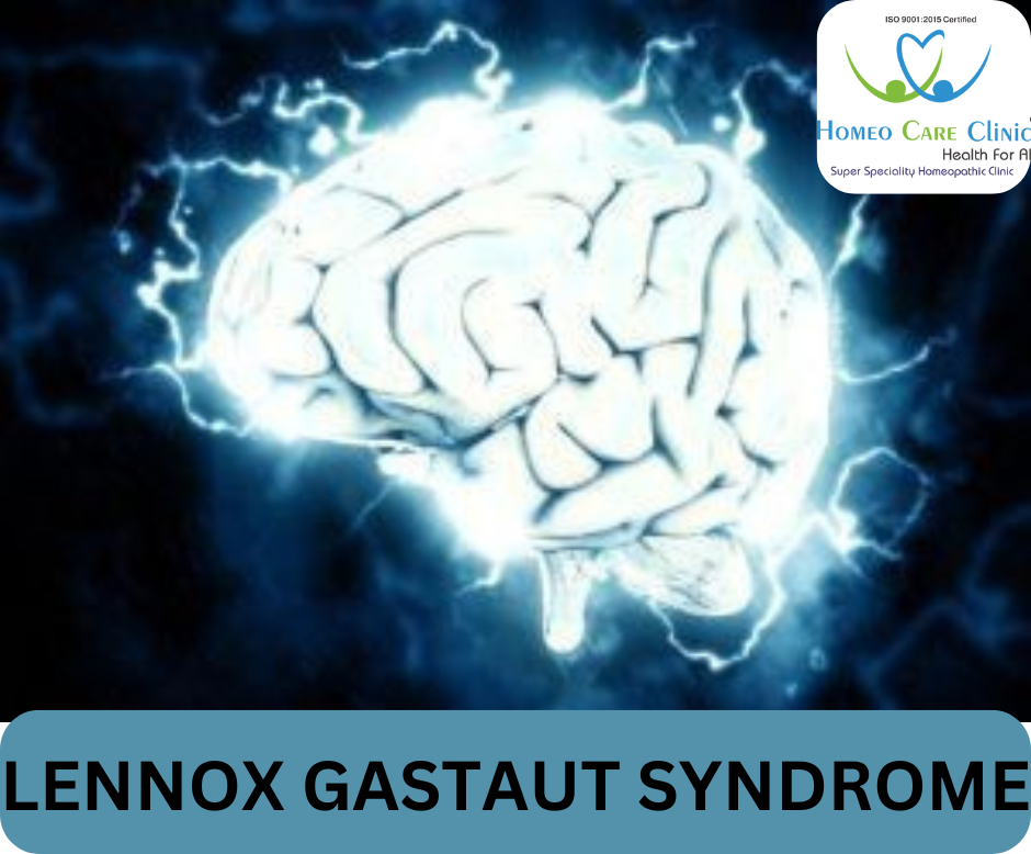 Lennox-Gastaut Syndrome symptoms and treatments