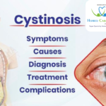 Causes and Treatment of Cystinosis