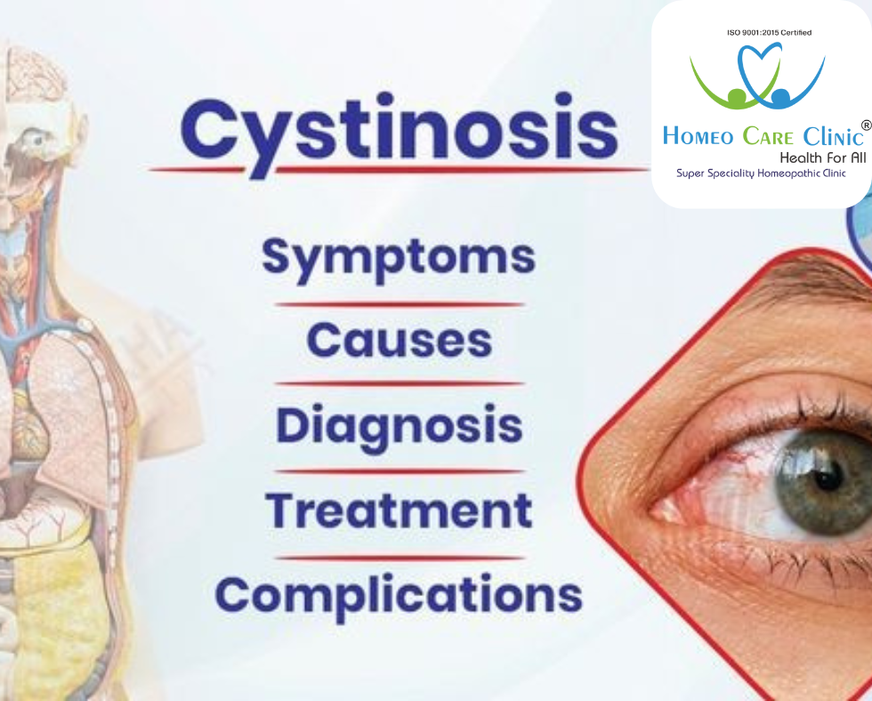 Causes and Treatment of Cystinosis