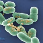 Understanding listeriosis causes