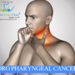 Homeopathic remedies for oropharyngeal cancer symptoms