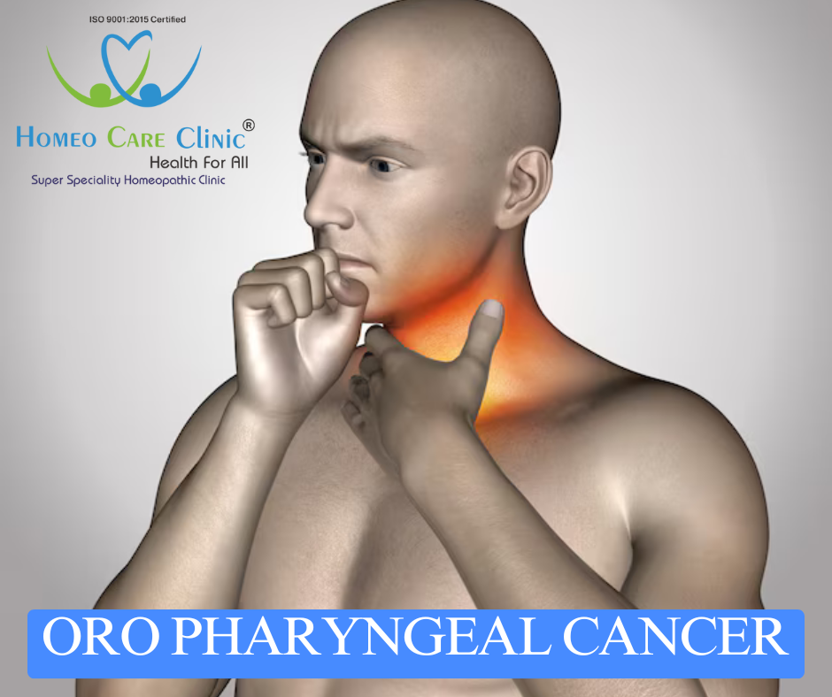 Homeopathic remedies for oropharyngeal cancer symptoms