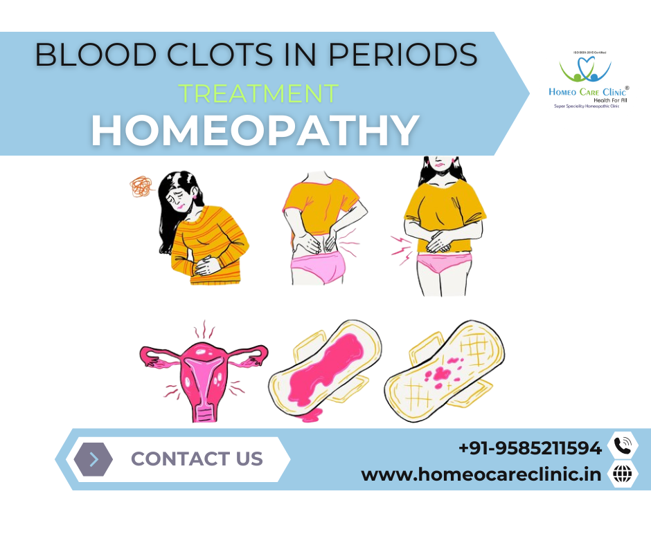 Heavy menstrual bleeding with blood clots