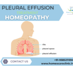 pleural effusion with homeopathy