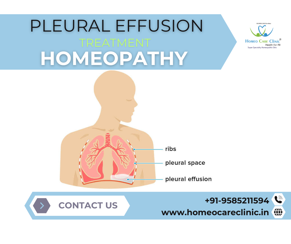 pleural effusion with homeopathy