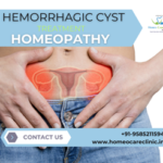 Homeopathy for hemorrhagic cysts explained