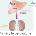 Homeopathic treatment for Primary Hyperoxaluria