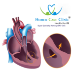 Acyanotic Heart Disease and its impact on heart health