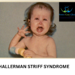 Hallermann-Streiff Syndrome Symptoms